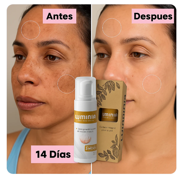 DESPIGMENTANTE FACIAL NIACINAMIDA LUMINIA DESPIGMENTANTE FACIAL NIACINAMIDA LUMINIA